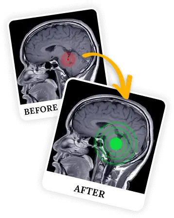 The Genius Wave Review: Image showing cognitive benefits such as focus, memory, and creativity.